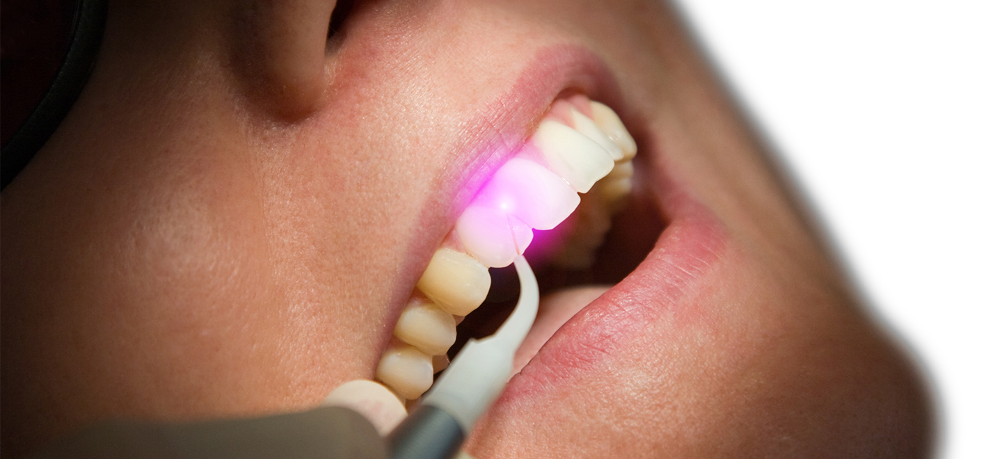 LASERBEHANDLUNG-1440x660